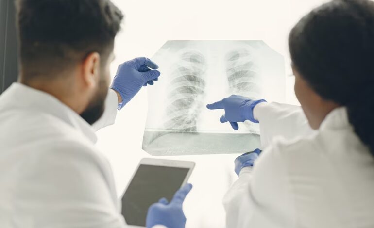 Los casos de tuberculosis aumentaron un 65% en Argentina en 5 años: cuáles son las razones, según los expertos