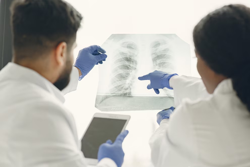 Los casos de tuberculosis aumentaron un 65% en Argentina en 5 años: cuáles son las razones, según los expertos