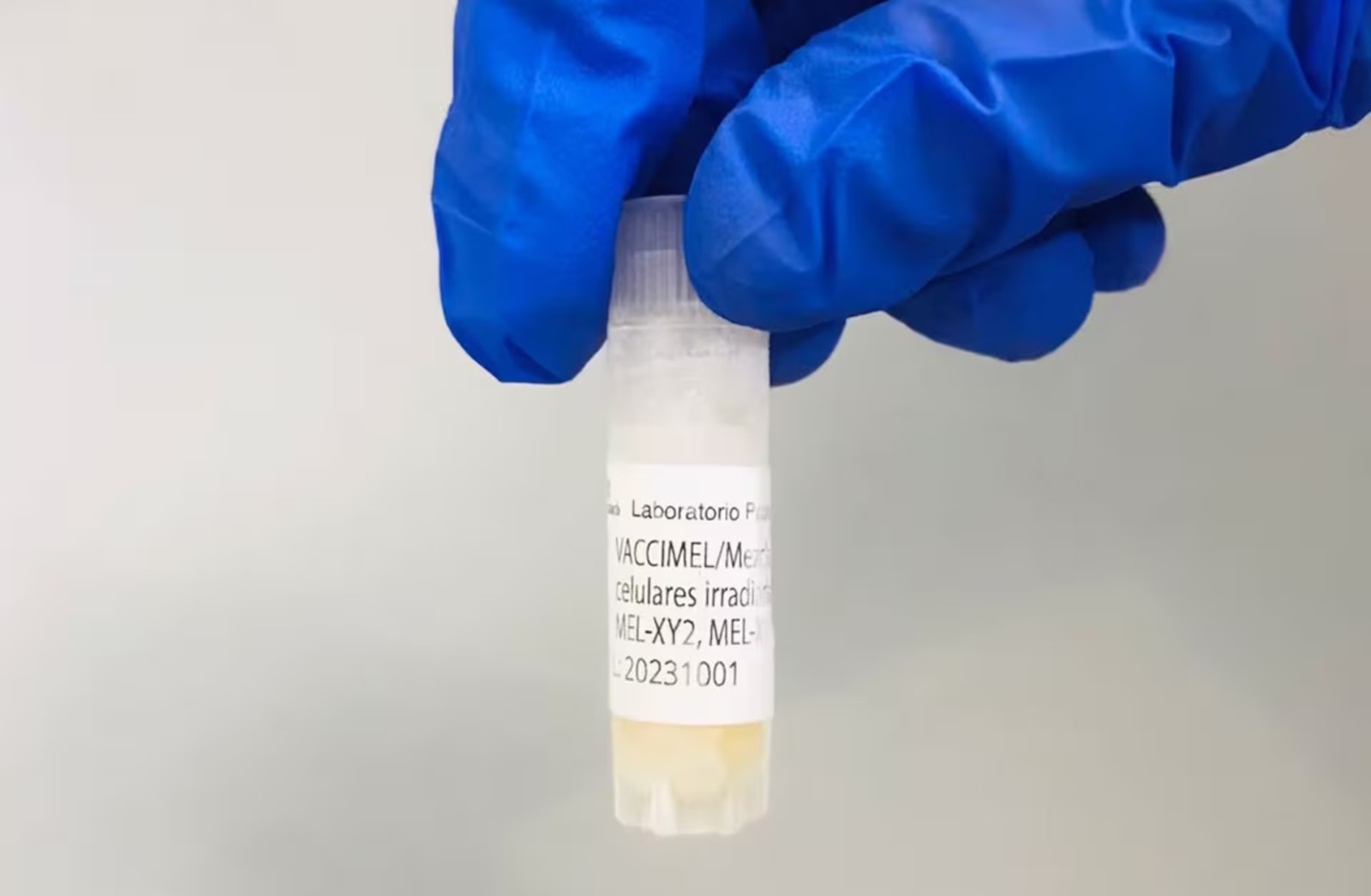 Cáncer de piel: ¿cómo actúa la nueva vacuna desarrollada por científicos argentinos?